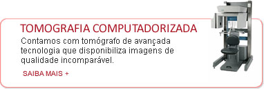 Tomografia Computadorizada
